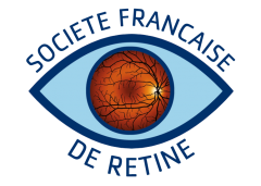 Sfretine